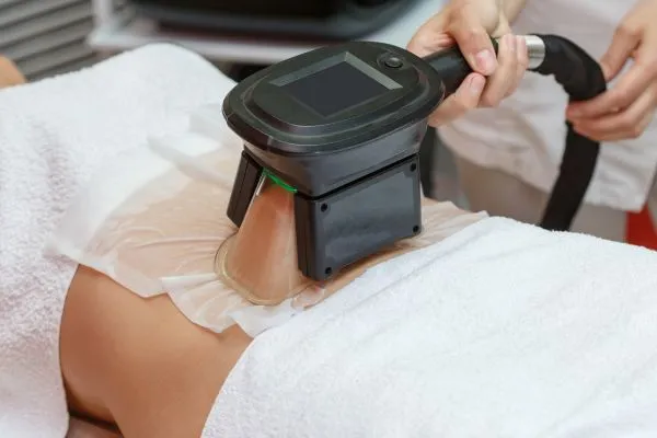 Image of person having fat freezing treatment to help weight gain Kington