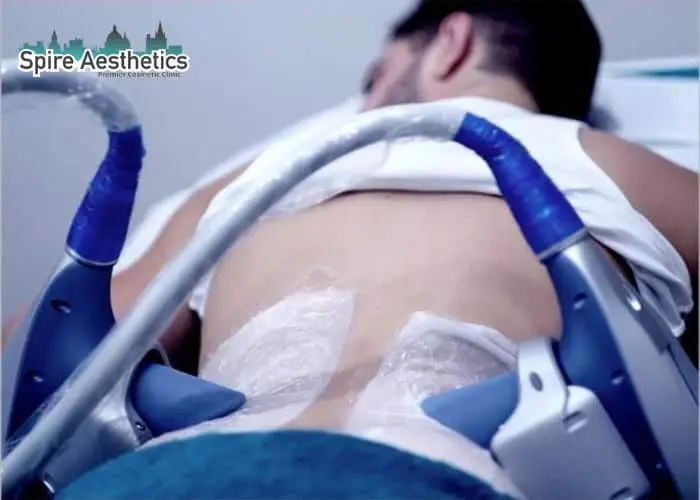 Man having fat freezing treatment done on love handles before a competitions Kington to create a sculpted look.